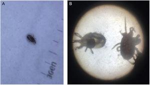 (A) Dermatoscopia do ácaro. (B) Identificação de ácaros da espécie Dermanyssus gallinae através de microscopia óptica.