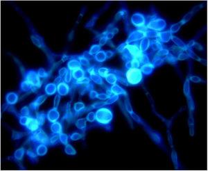 Microscopia com cálcio fluorescente do esfregaço da colônia, evidencia ramificações separadas de micélio com protrusões irregulares e esporos de paredes espessas de tamanhos variados em colônia cultivada em meio PDA a 25°C por 14 dias, 1000×.