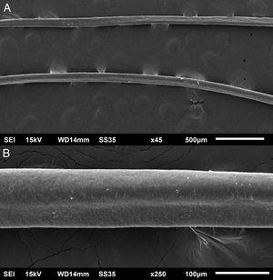 Microscopia eletrônica de varredura – exame dos cabelos mostrando canais na haste pilar. (A), Pequeno aumento (45×). (B), Médio aumento (250×).