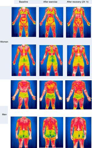 Examples of thermograms collected in men and women: at rest, after exercise, and after a 24-h recovery period. The considered body regions of interest can be viewed.