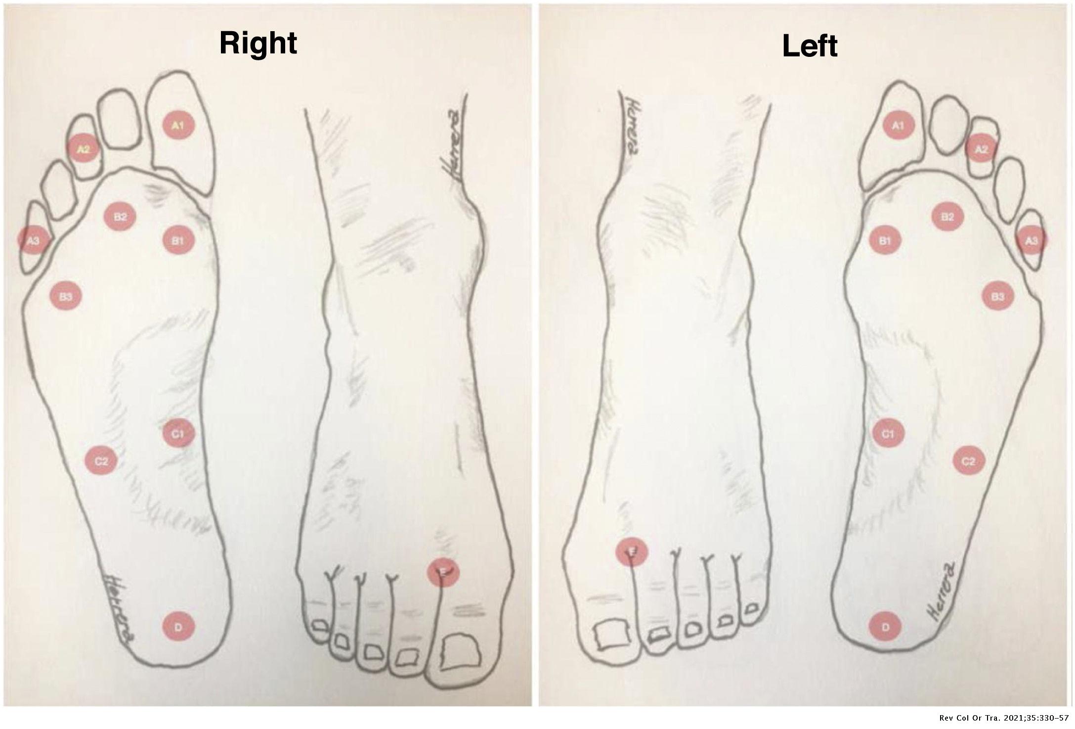 Diabetic Foot Exam Template Diabetic Foot Exam Template