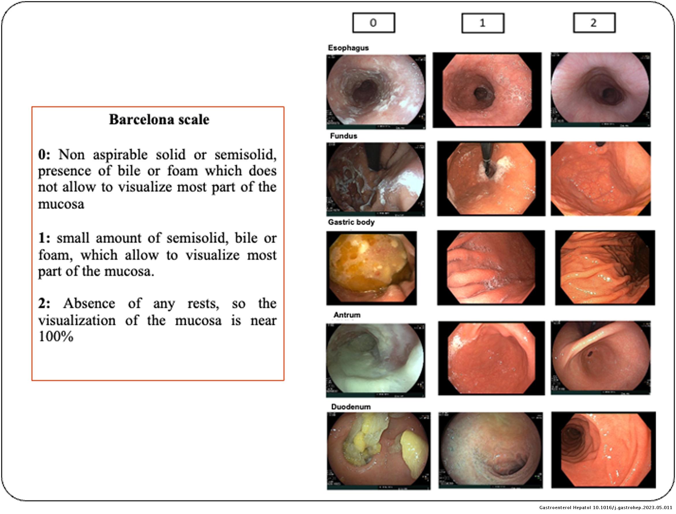 Applicability of the Barcelona scale to assess the quality of ...