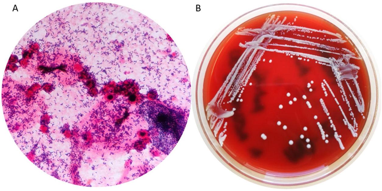 Actinomyces Colony Morphology