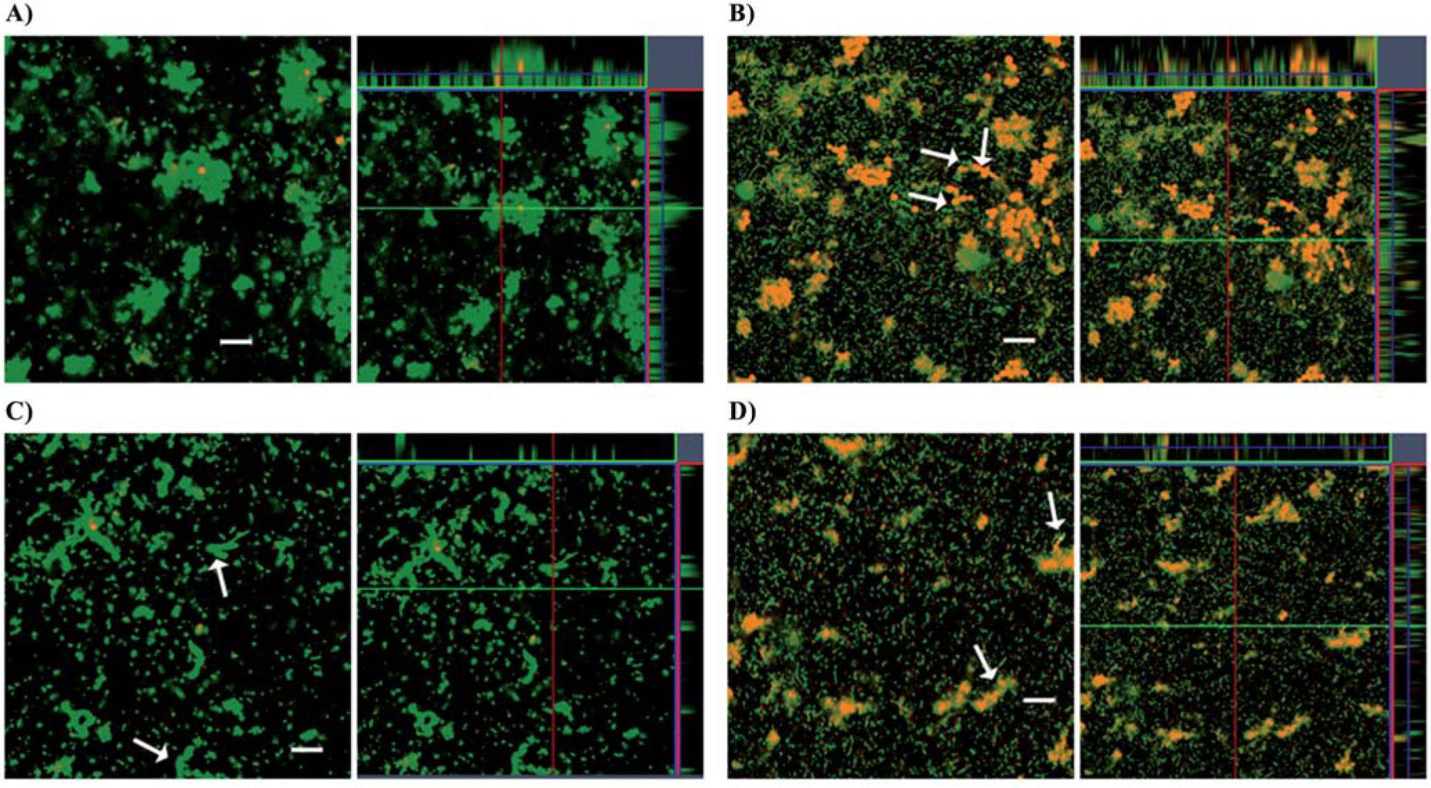 Stenotrophomonas Maltophilia Interferes Via The DSF Mediated Quorum   Gr5 