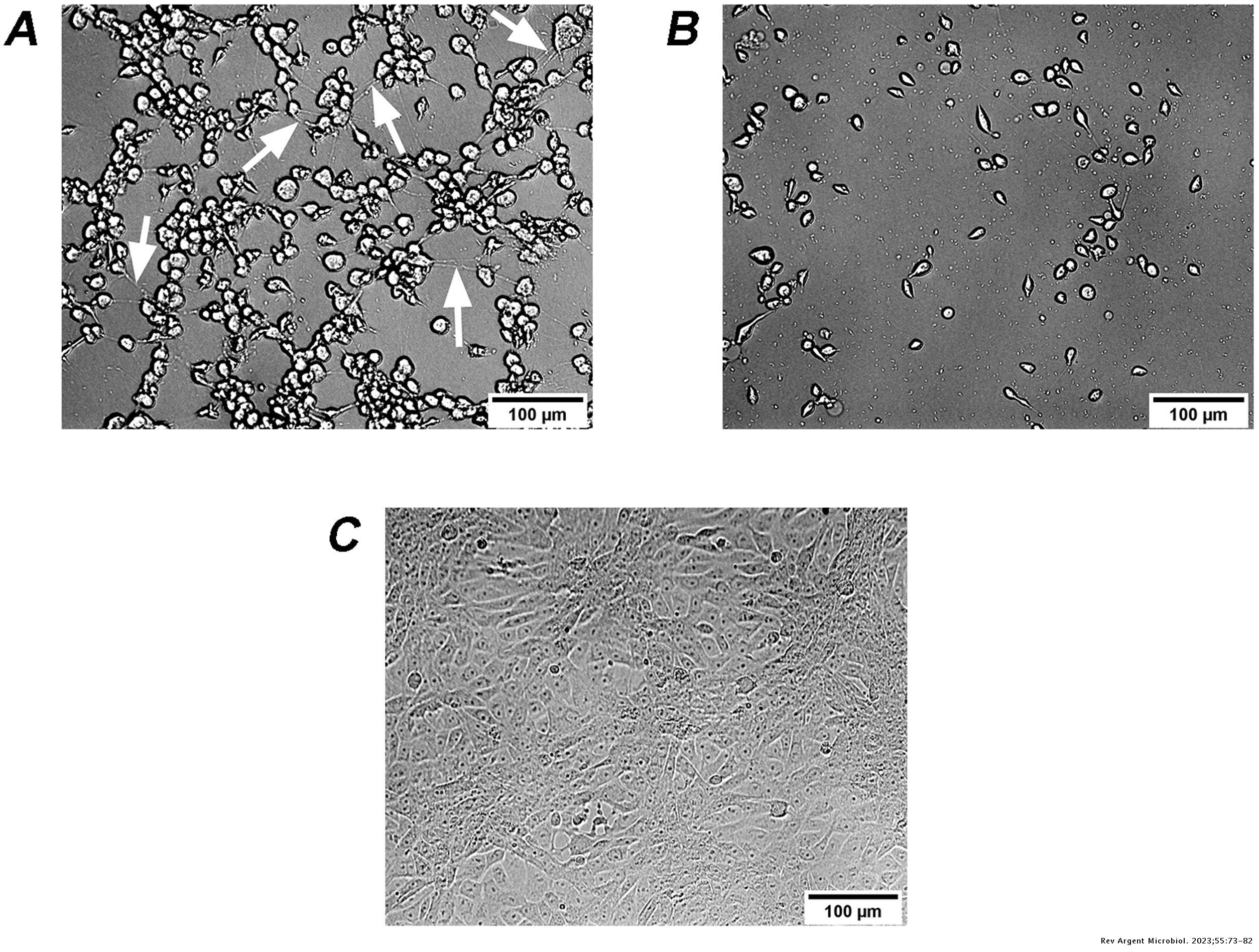 Clostridioides difficile: Characterization of the circulating ...