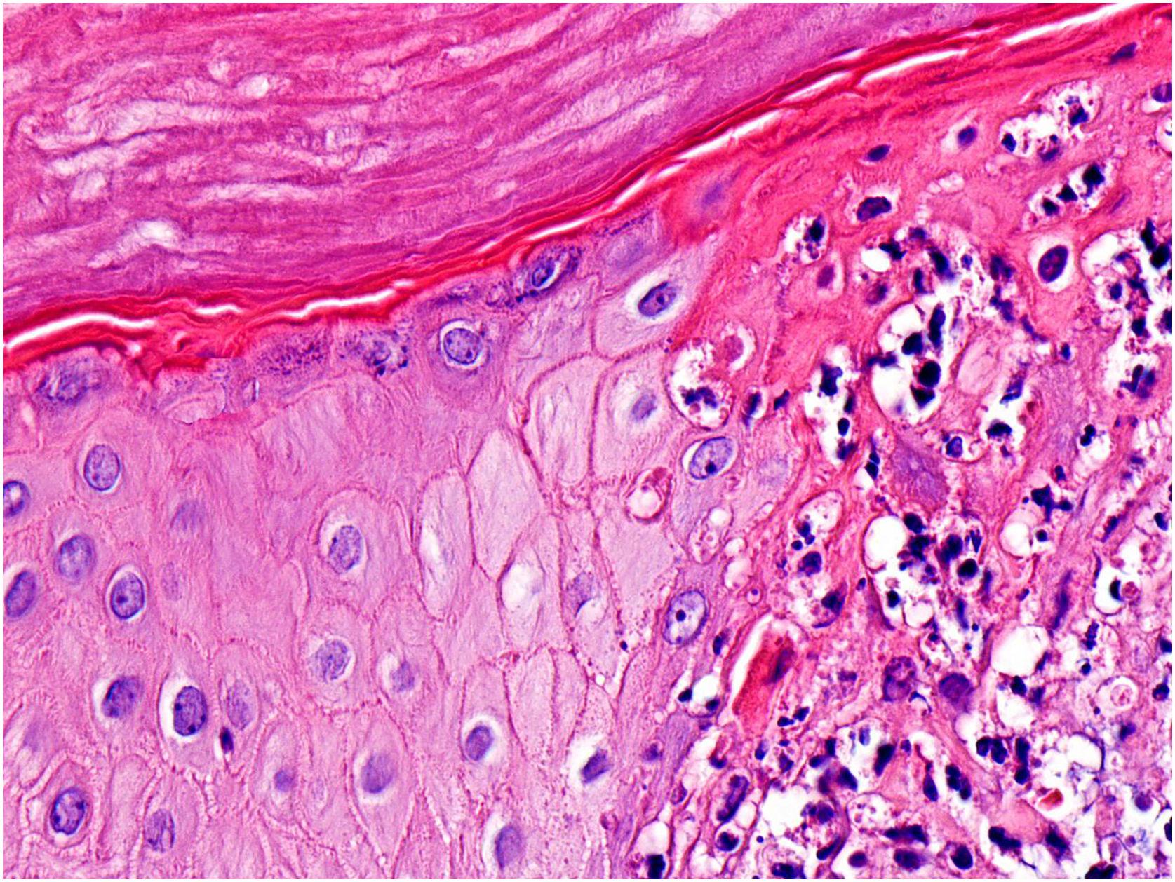 2022 Mpox (monkeypox) outbreak: a concise review focused on new ...