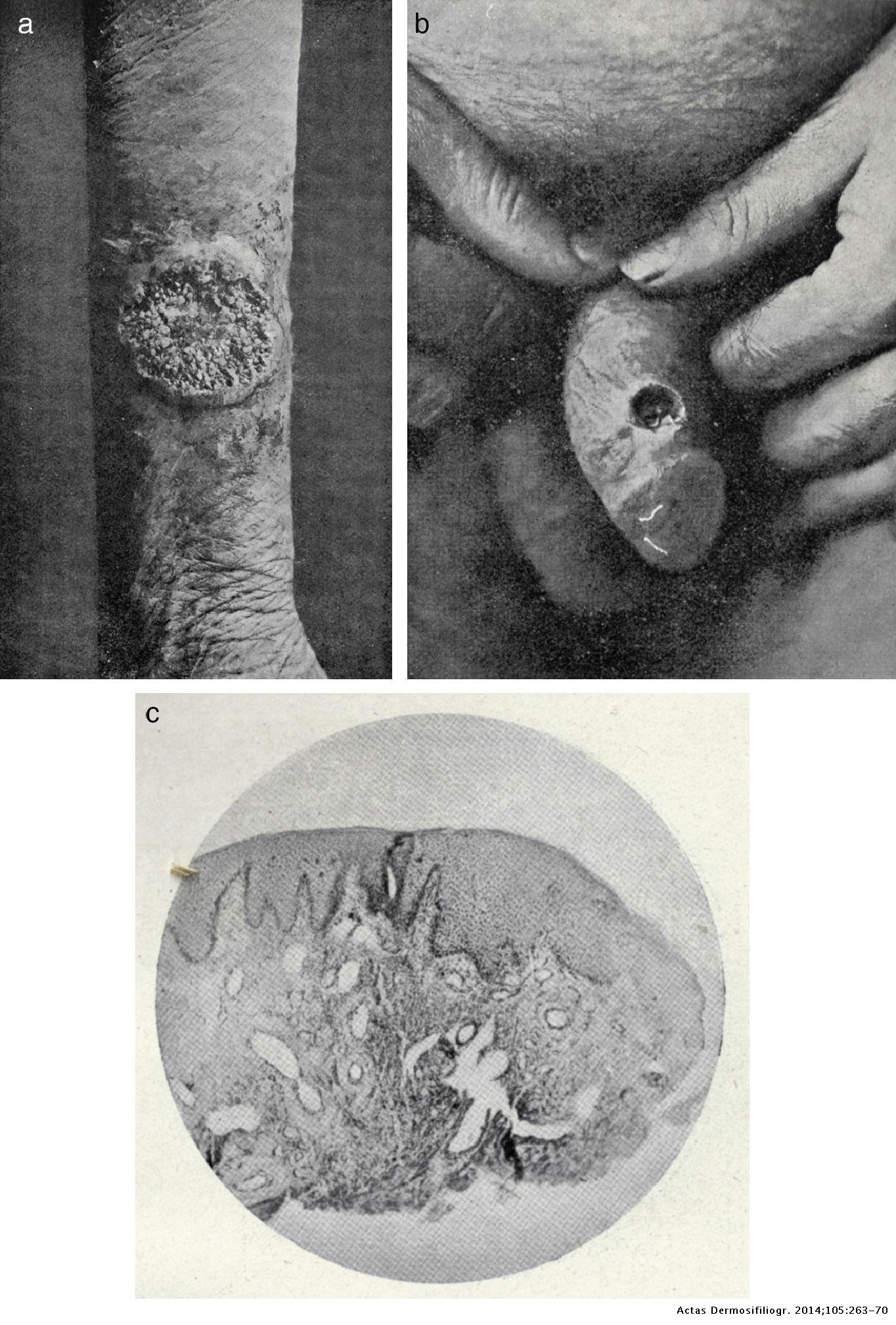 The Elements of Dermatology: The Legacy of Covisa and Bejarano | Actas ...
