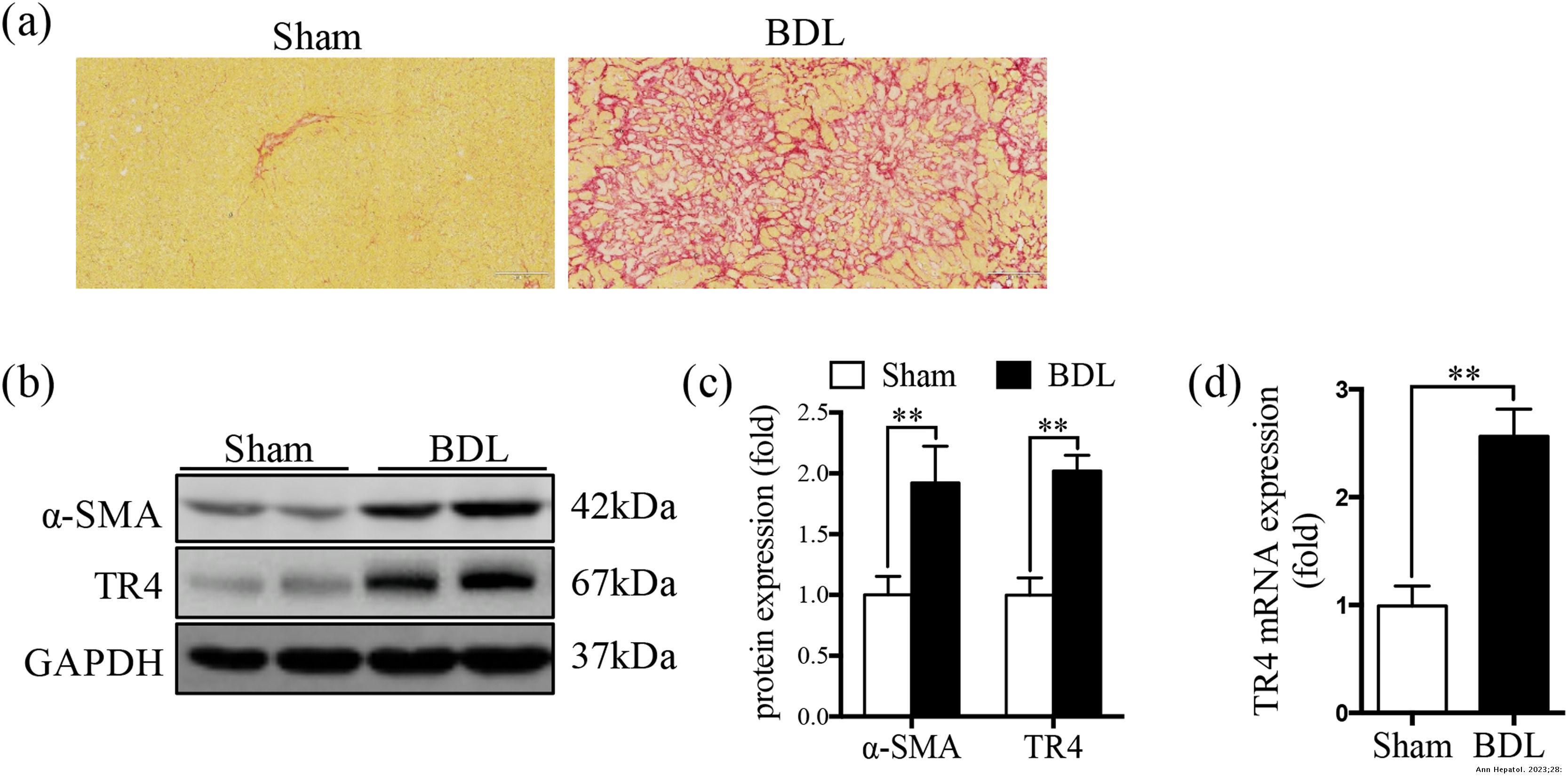 Testicular orphan receptor 4 induced hepatic stellate cells activation