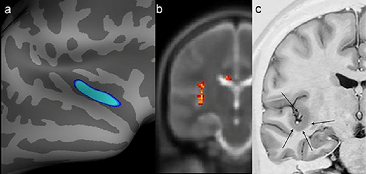 Multimodal Quantitative Magnetic Resonance Imaging Analysis With ...