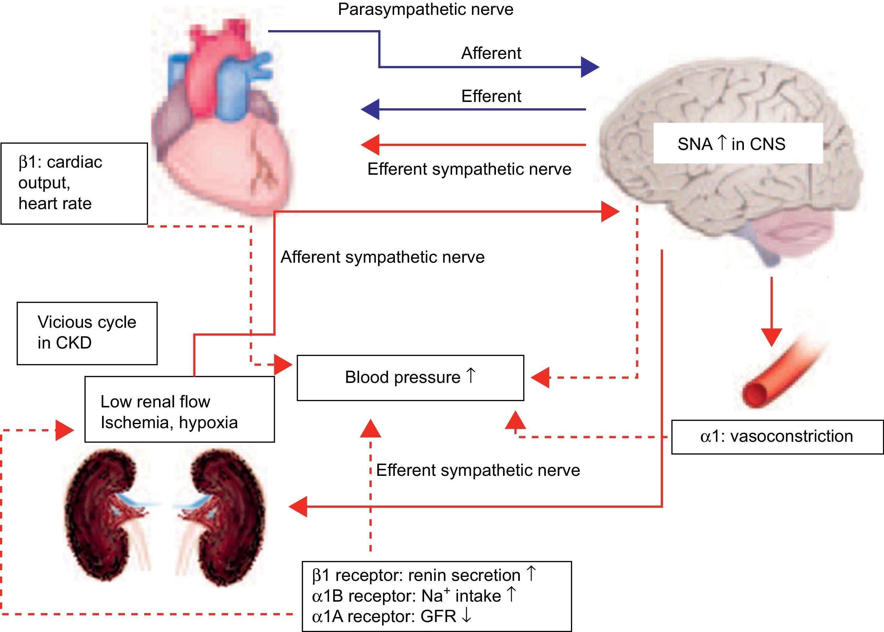 New Treatment For Old Disease: Management Of Resistant Hypertension By ...