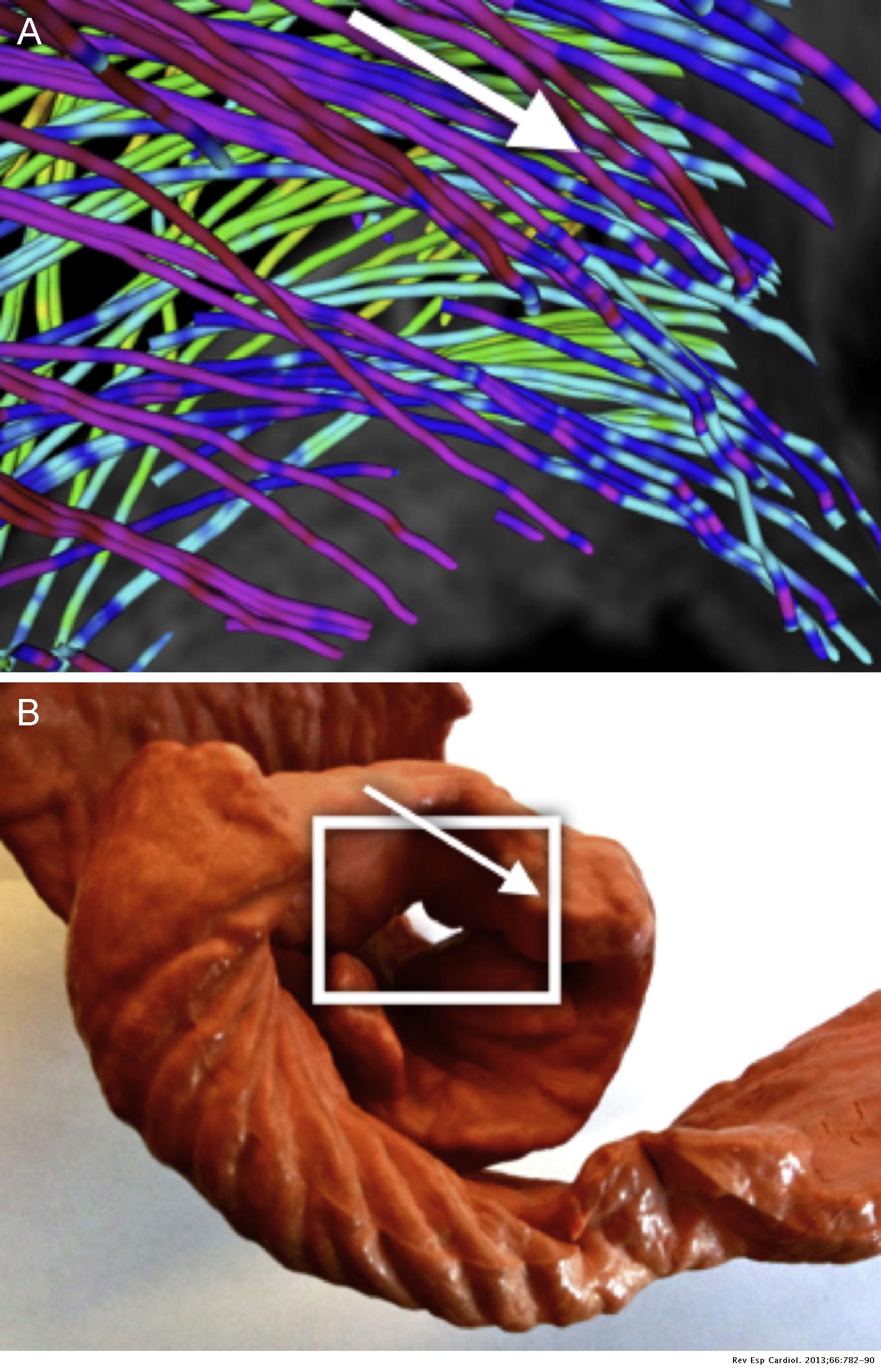 Helical Structure of the Cardiac Ventricular Anatomy Assessed by ...
