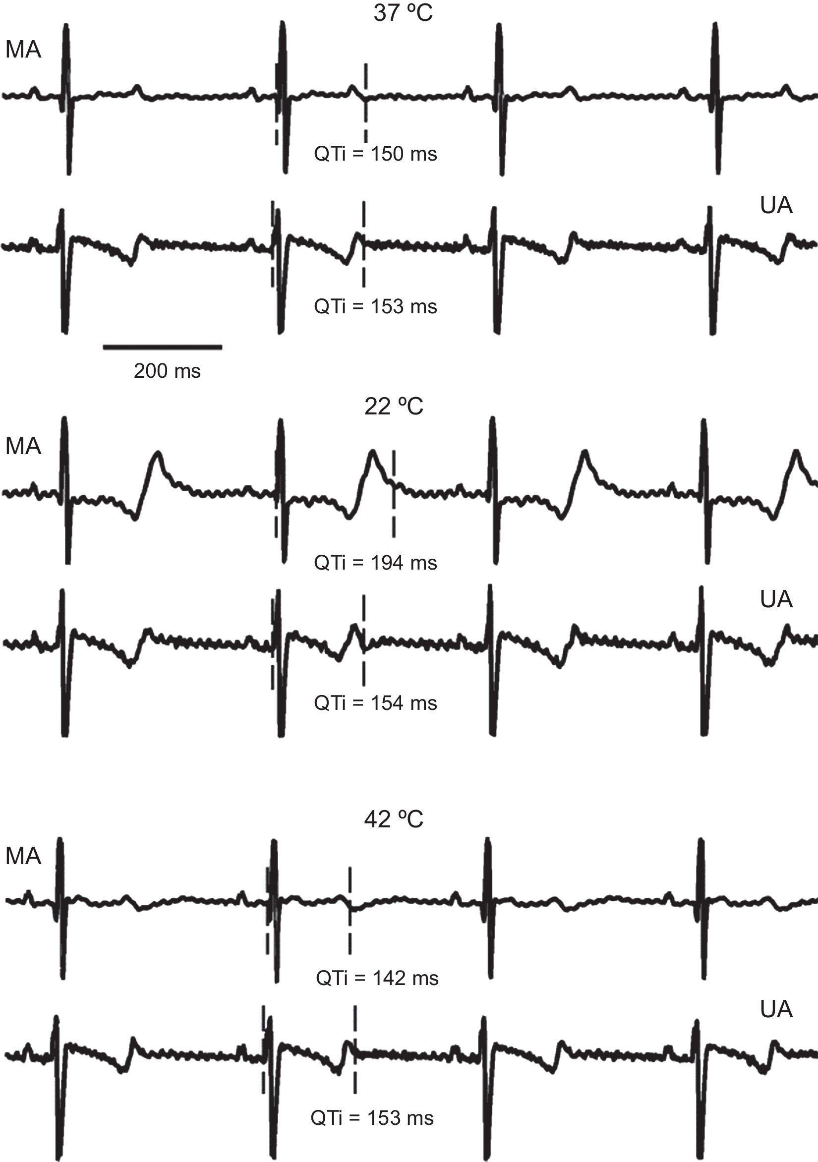 QT Interval Heterogeneities Induced Through Local Epicardial Warming ...