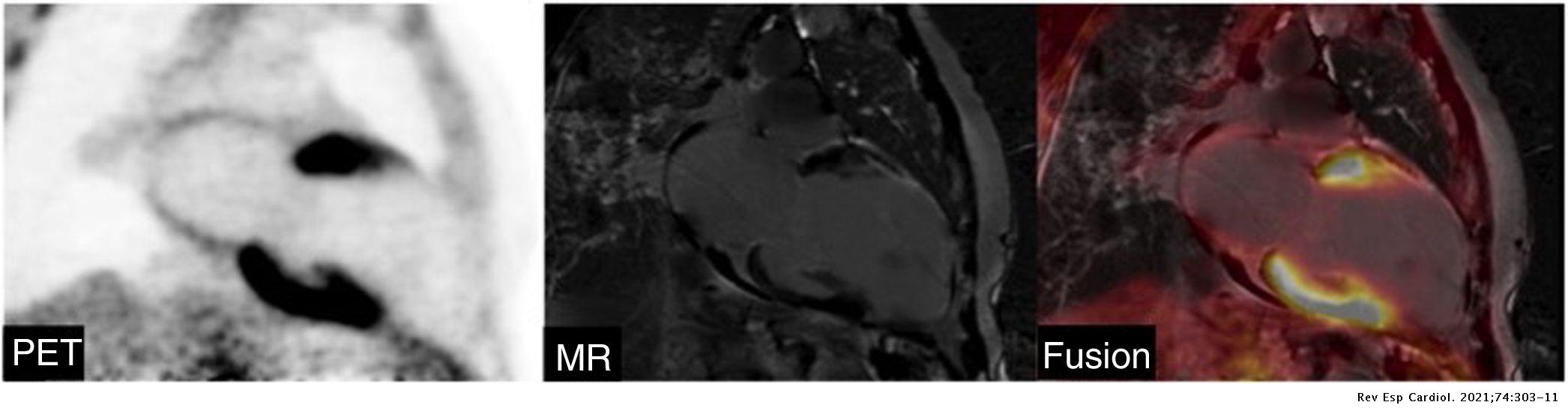 Additional value of hybrid PET/MR imaging versus MR or PET performed ...