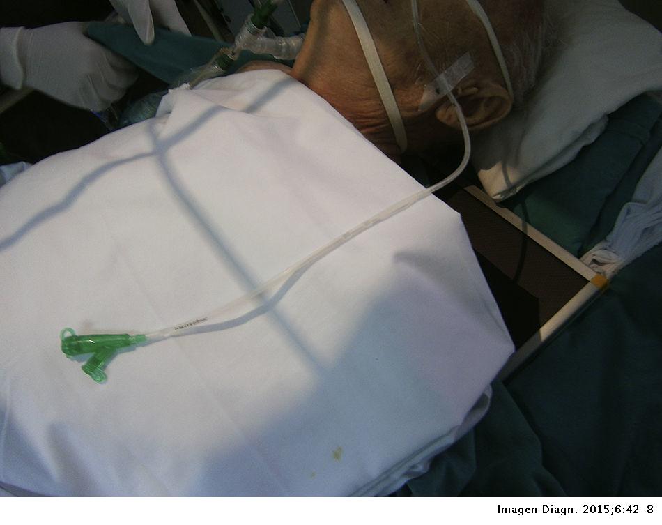 Aciertos bacteriológicos en las mesas y chasis radiológicos en el ...