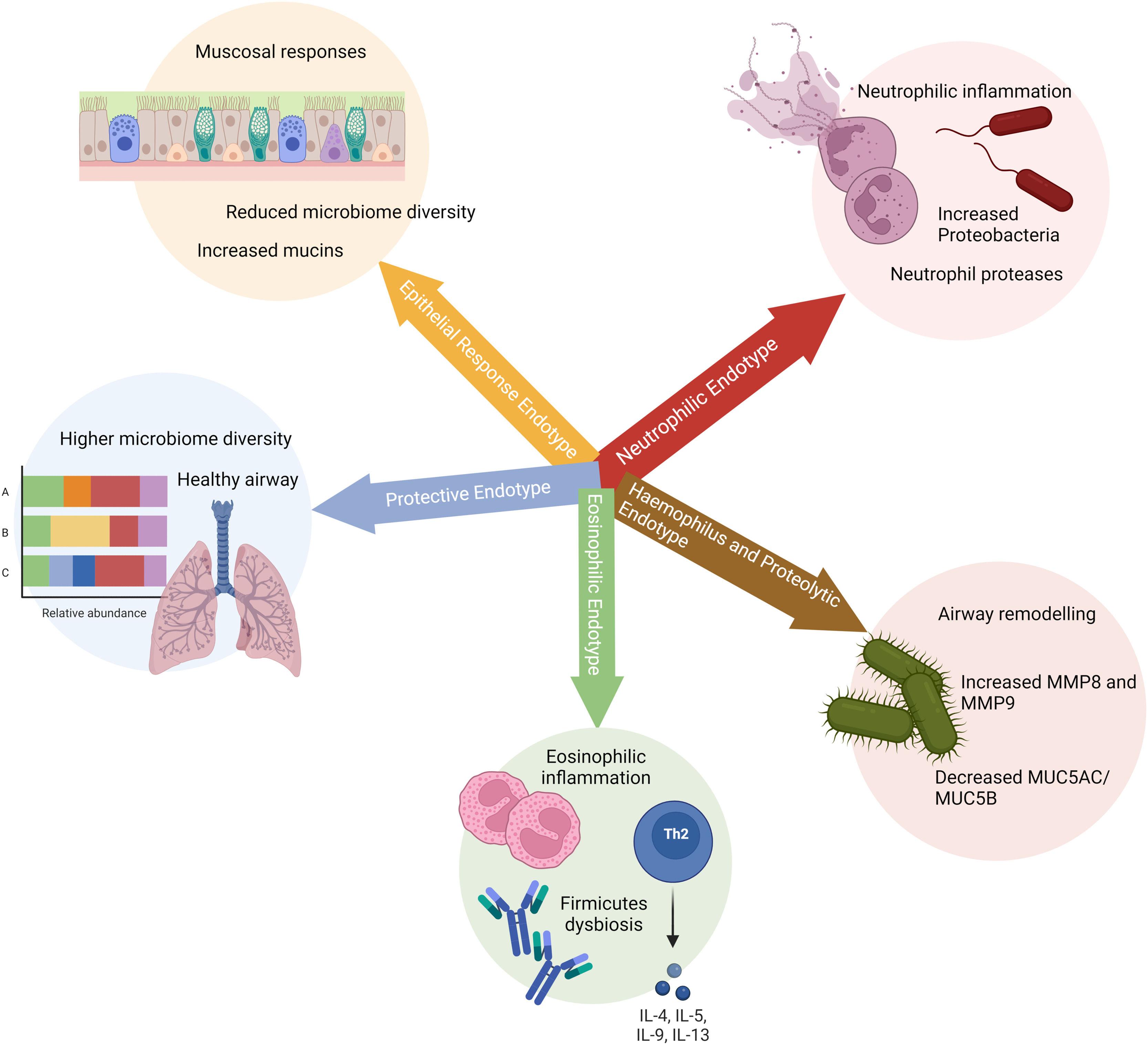 Endotypes In Bronchiectasis: Moving Towards Precision Medicine. A ...