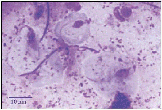 baktériumvetés a Trichomonas flóráján