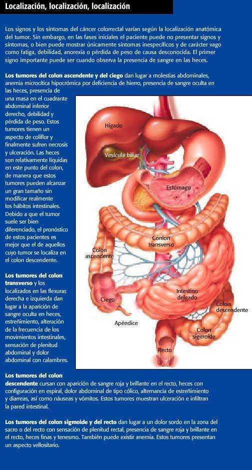 cancer de colon derecho nasal papilloma pathology outlines