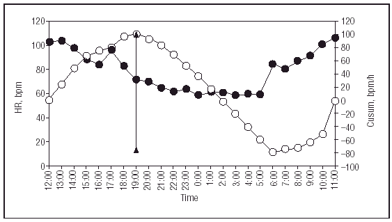 Circadian Profiles Of Heart Rate And Its Instantaneous Variability In Patients With Chronic Chagas Disease Revista Espanola De Cardiologia