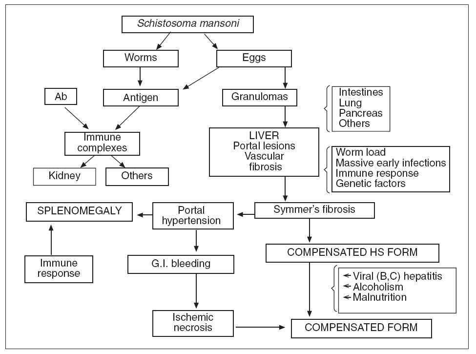 schistosomiasis patológia a condyloma etiológiájának patogenezise