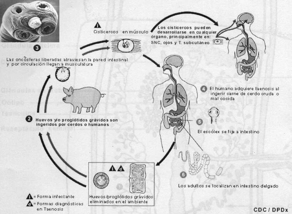 escólex de tenia solium
