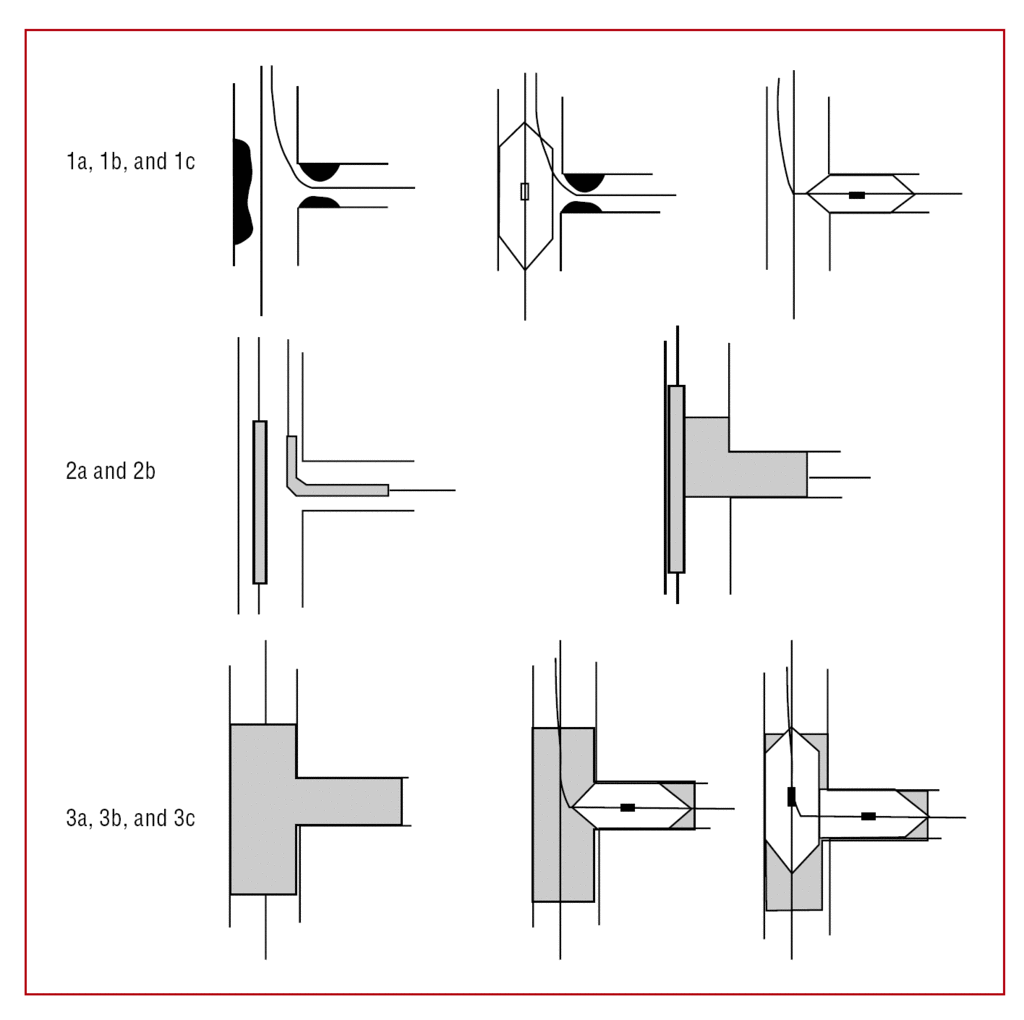 Percutaneous Treatment Of Bifurcation Lesions By Crush T Stenting Immediate And Medium Term Outcomes Revista Espanola De Cardiologia