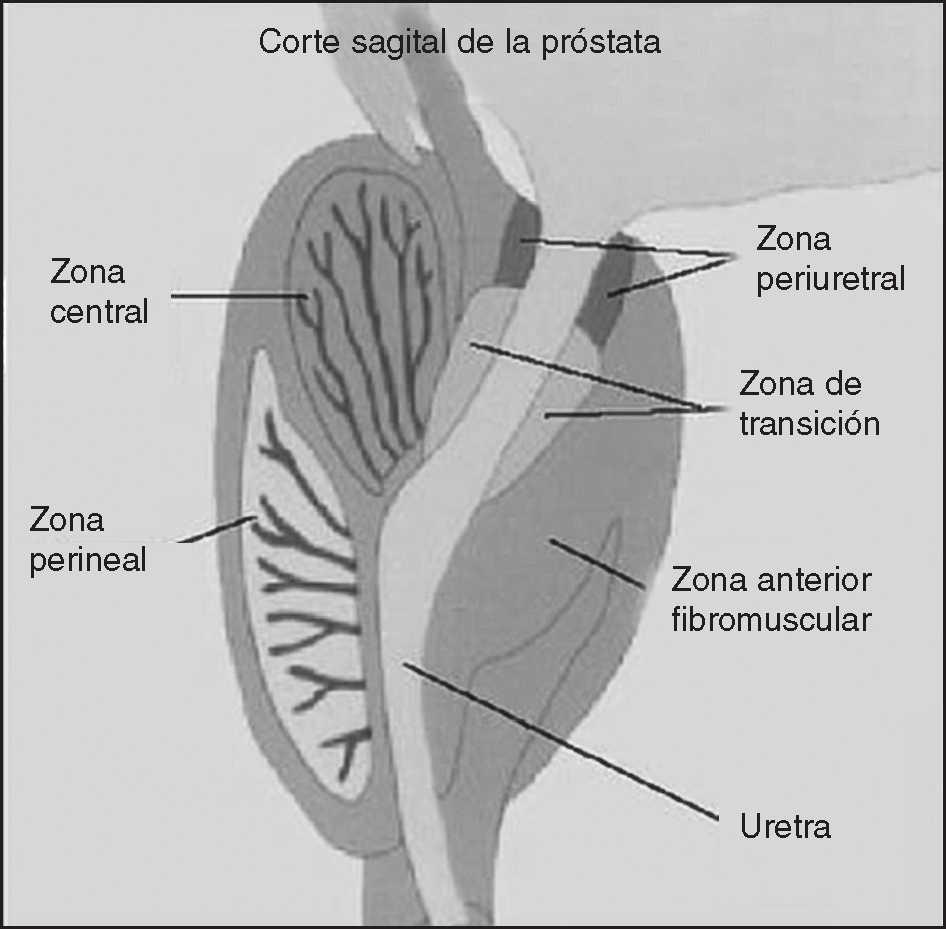 poze cu adenom de prostatită