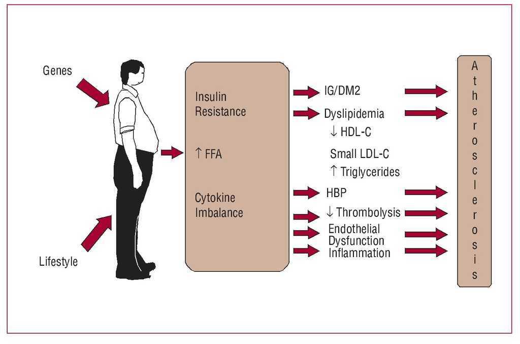 Impact of Body Mass Index and the Metabolic Syndrome on the Risk of  Cardiovascular Disease and Death in Middle-Aged Men