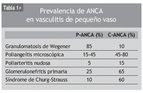 Cuando Solicitar Los Anticuerpos Anticitoplasma De Neutrofilo Seminarios De La Fundacion Espanola De Reumatologia