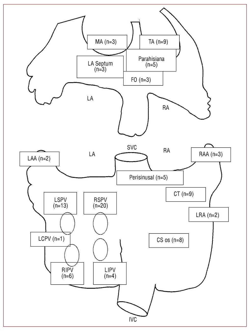 Atrial Tachycardia Originating From The Pulmonary Vein Clinical Electrocardiographic And Differential Electrophysiologic Characteristics Revista Espanola De Cardiologia