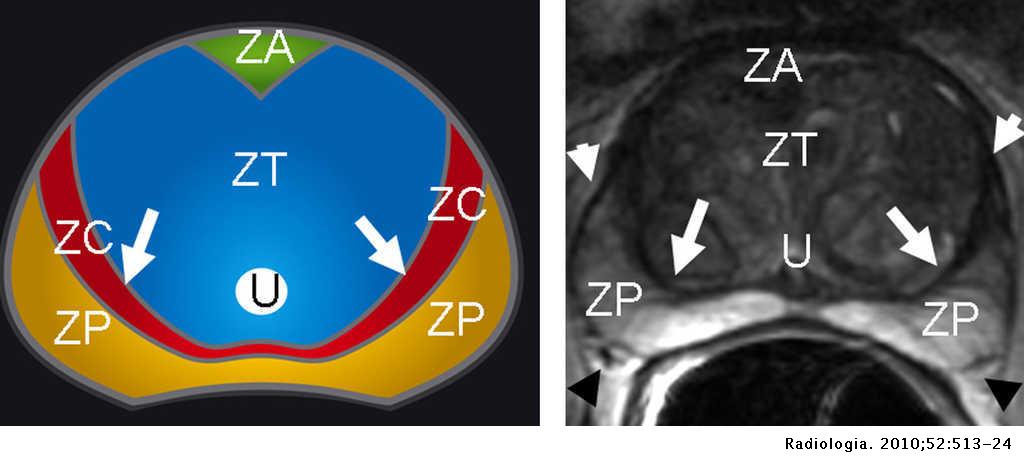 anatomia radiologica próstata)