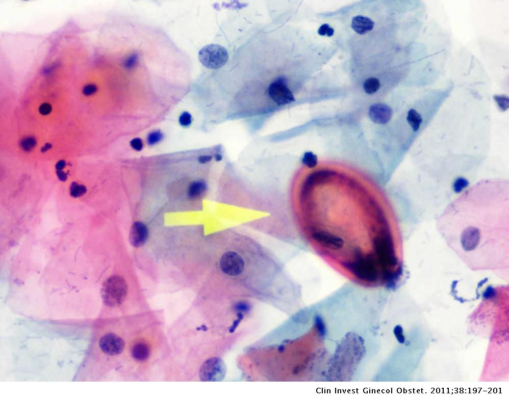 oxiuros histologia