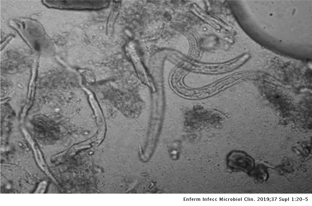 Aszcariasis trichocephalosis enterobiosis hookworm és necatorosis