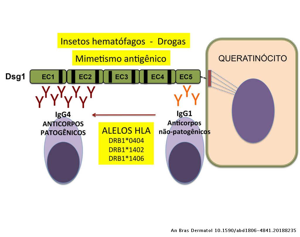 Fogo selvagem endemic pemphigus foliaceus* Anais Brasileiros de Dermatologia Fogo selvagem endemic pemphigus foliaceus* Anais Brasileiros de Dermatologia