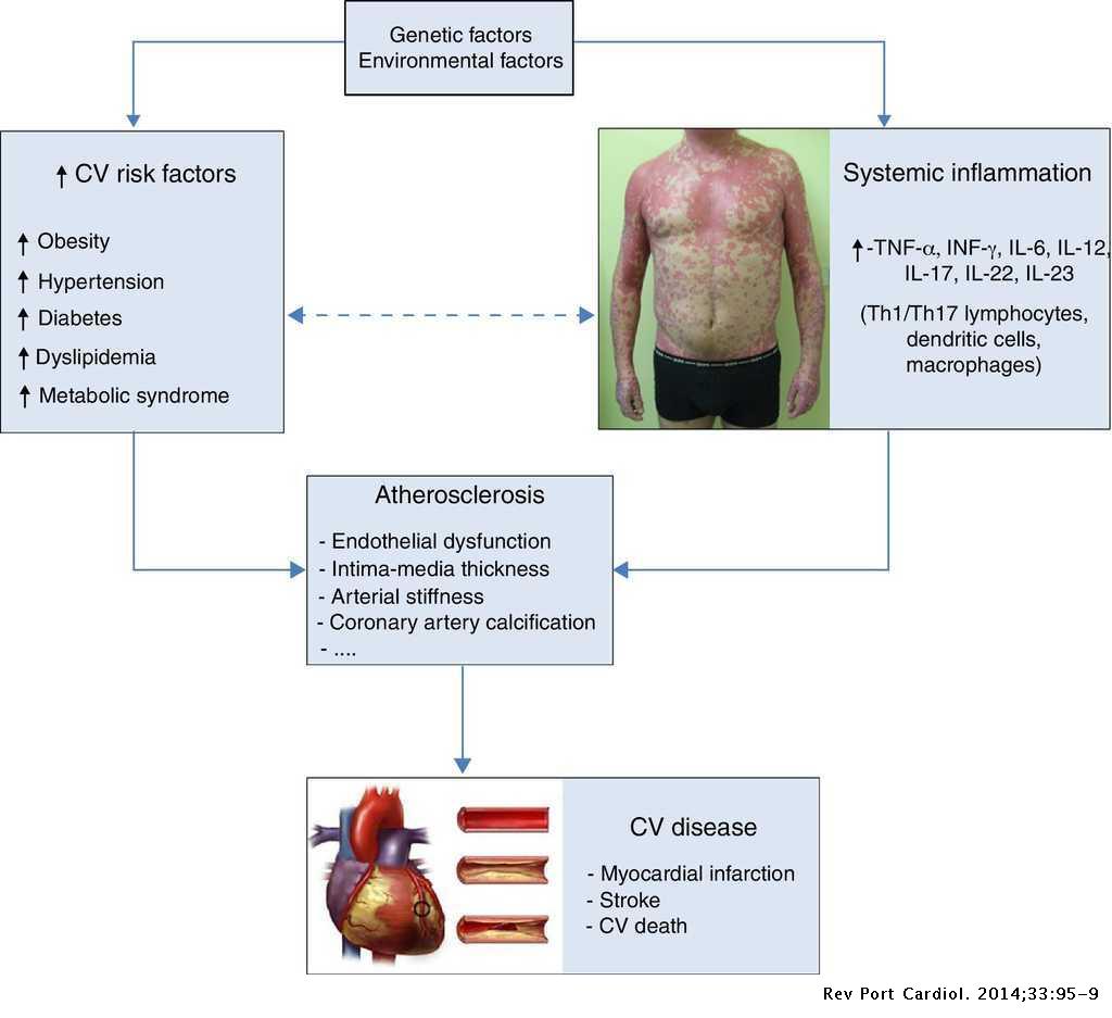 plaque psoriasis heart disease)