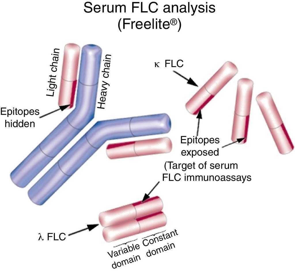 serum-free-light-chain-assays-not-total-light-chain-assays-are-the