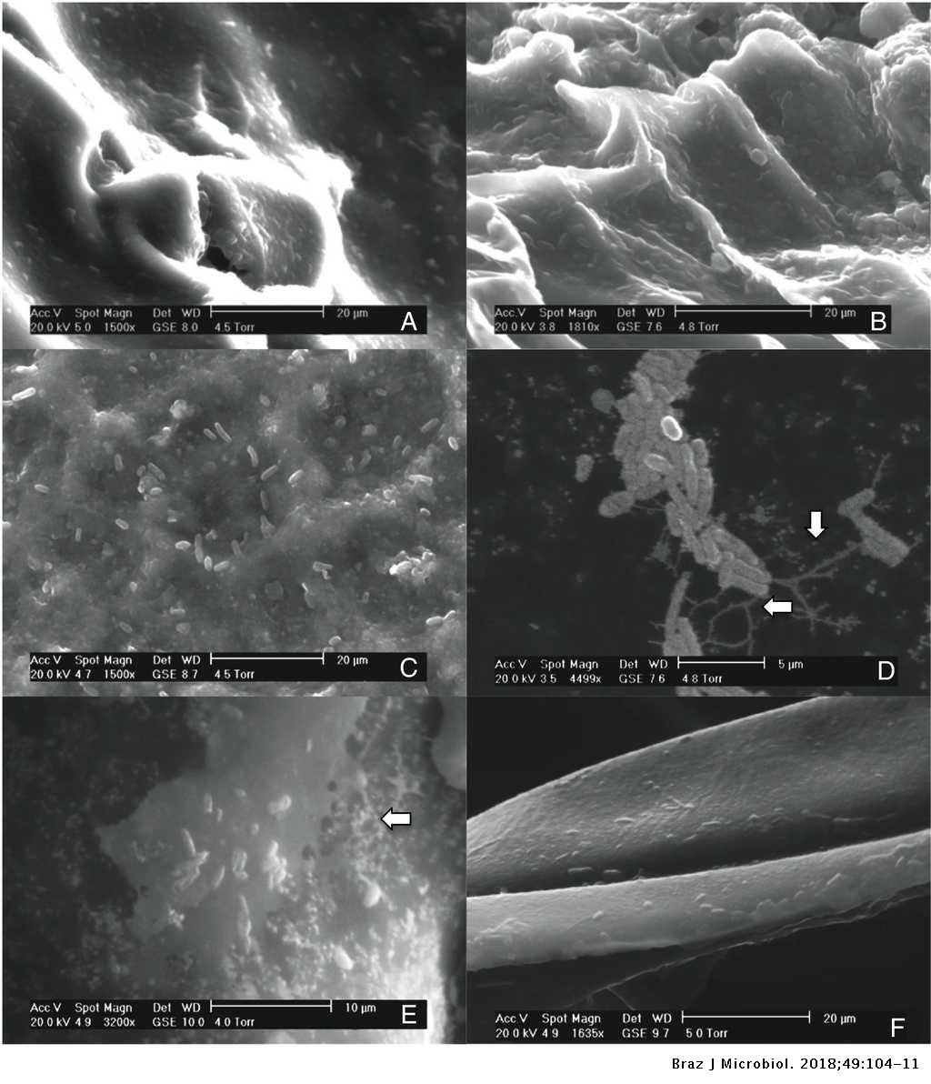 Growth Kinetics Of Escherichia Coli O157 H7 On The Epicarp Of Fresh Vegetables And Fruits Brazilian Journal Of Microbiology
