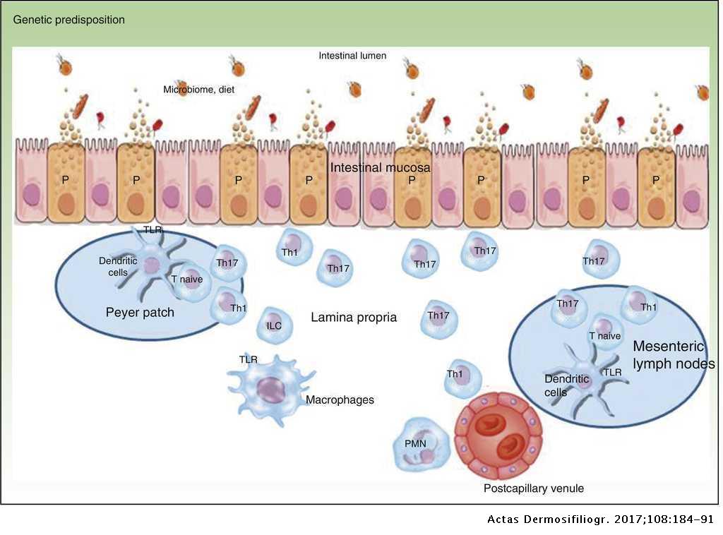 Inflammatory Bowel Disease Joint Management In Gastroenterology And Dermatology Actas Dermo Sifiliograficas Inflammatory Bowel Disease Joint Management In Gastroenterology And Dermatology Actas Dermo Sifiliograficas