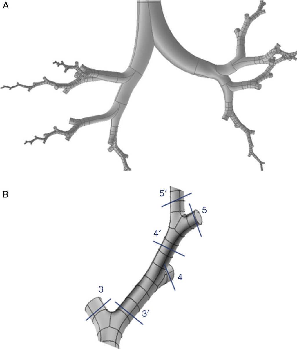 Use of Computational Fluid Dynamics in Respiratory Medicine | Archivos ...