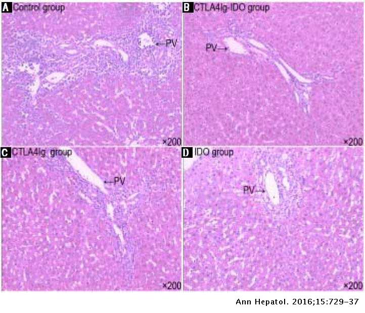 Effects Of Combined Genes Of Ctla4ig And Ido In Post Liver Transplantation Immune Tolerance Of Rats Annals Of Hepatology
