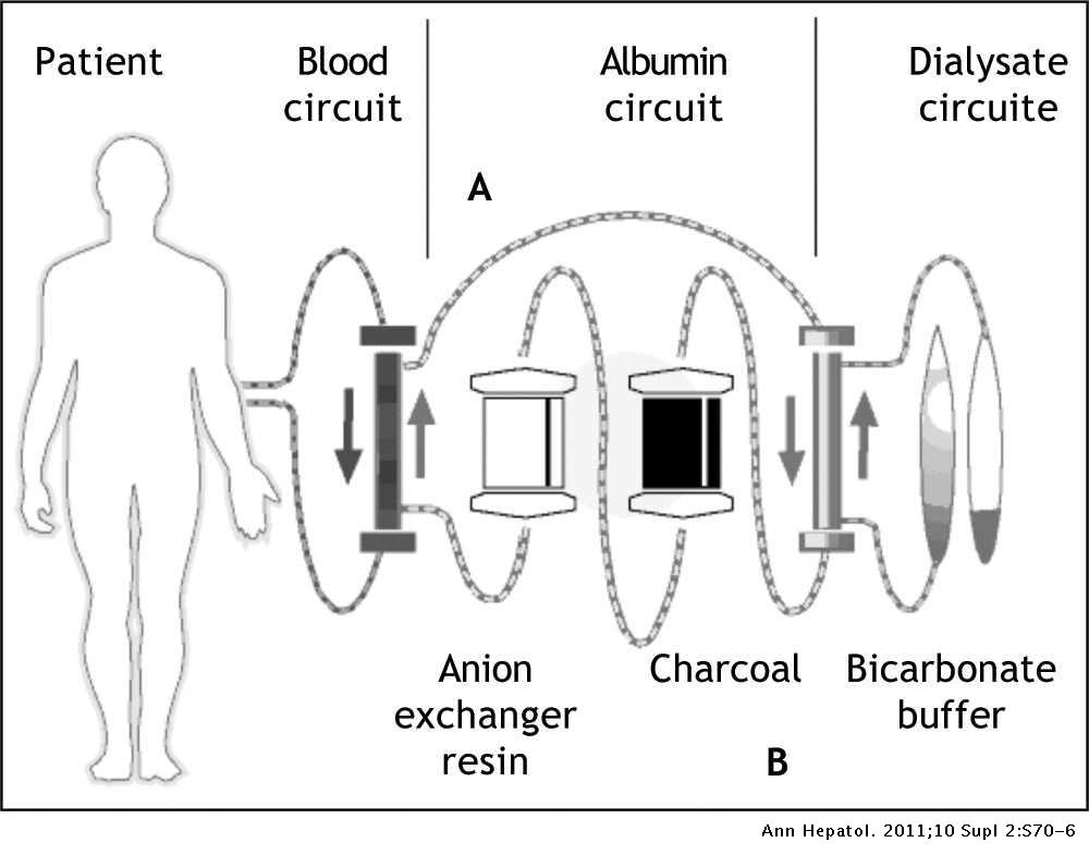 Goals of MARS Therapy in Graft Dysfucntion After Liver Transplant Goals of MARS Therapy in Graft Dysfucntion After Liver Transplant