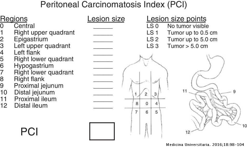 peritoneal cancer index