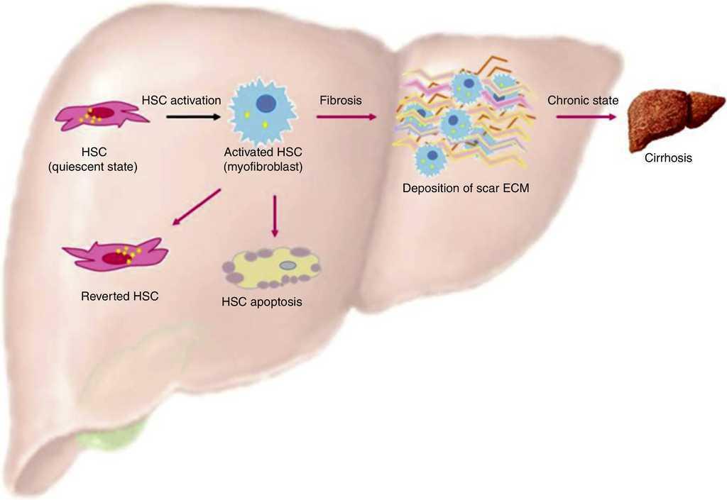 Mechanisms involved in liver damage resolution after hepatitis C virus ...
