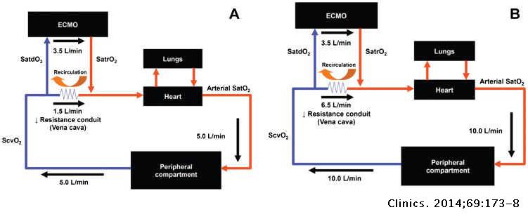 Severe hypoxemia during veno-venous extracorporeal membrane oxygenation ...