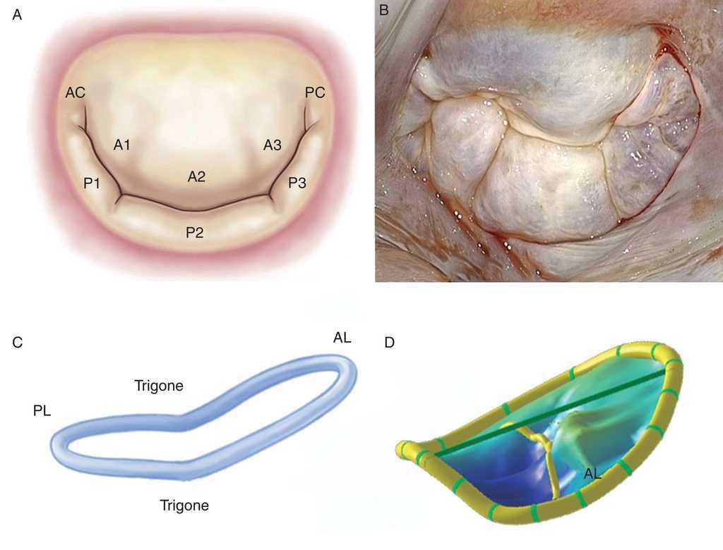 Surgical Echocardiography of the Mitral Valve | Revista Española de ...