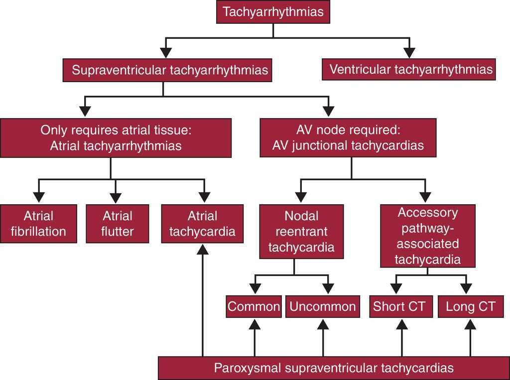 Supraventricular tachycardia treatment guidelines