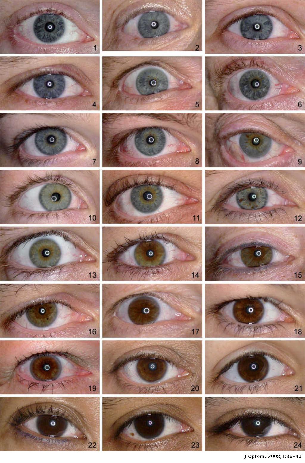 Grading of Iris Color with an Extended Photographic Reference Set