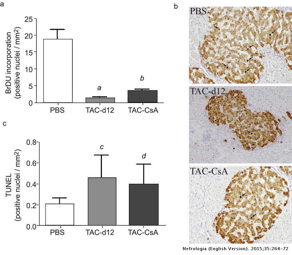 Glucose Homeostasis Changes And Pancreatic B Cell Proliferation After Switching To Cyclosporin In Tacrolimus Induced Diabetes Mellitus Nefrologia