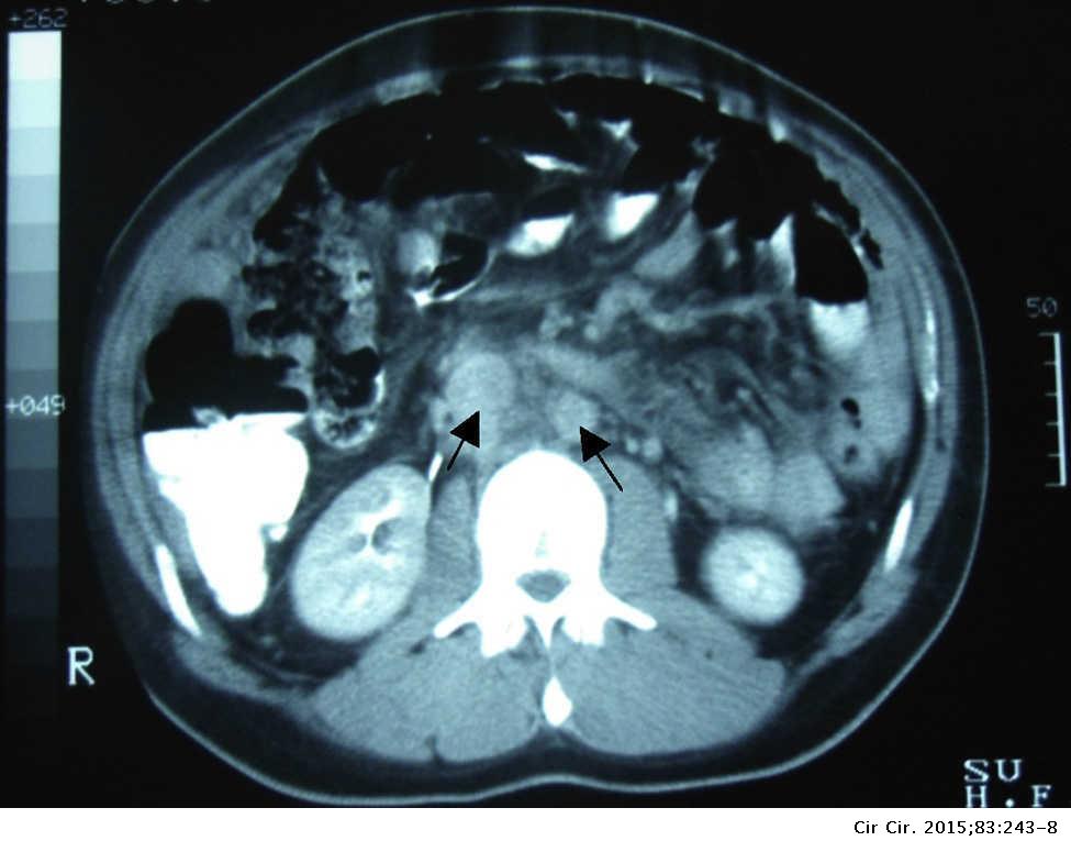 abdominal x ray showing constipation