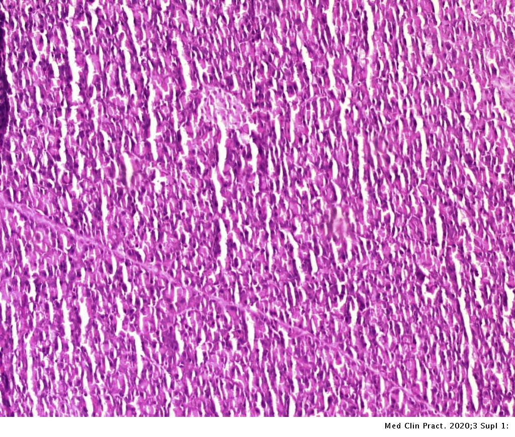 Breadfruit Leaves Extract Artocarpus Altilis Effect On Pancreatic Damage In Diabetic Type Ii Animal Model Induced By Alloxan Nicotinamide Medicina Clinica Practica