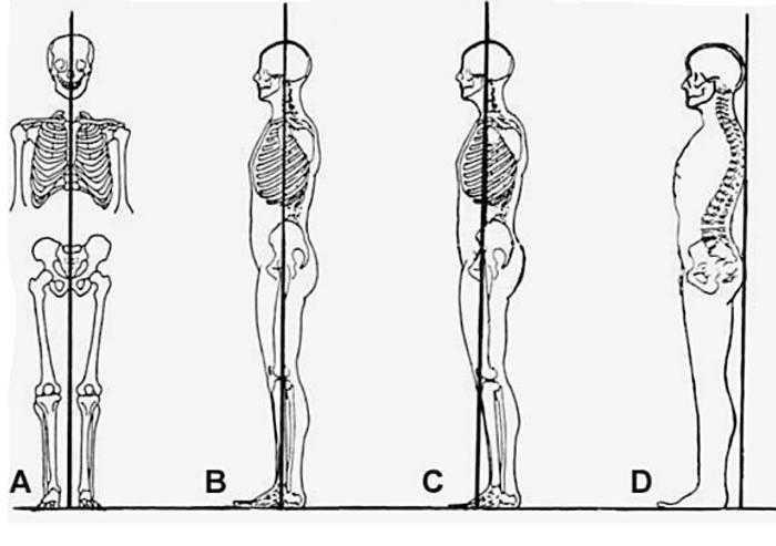 enero Touhou ir al trabajo Estudio de validación de un instrumento de evaluación postural (SAM, spinal  analysis machine) | Apunts Sports Medicine